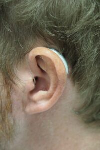 Audioprothésiste